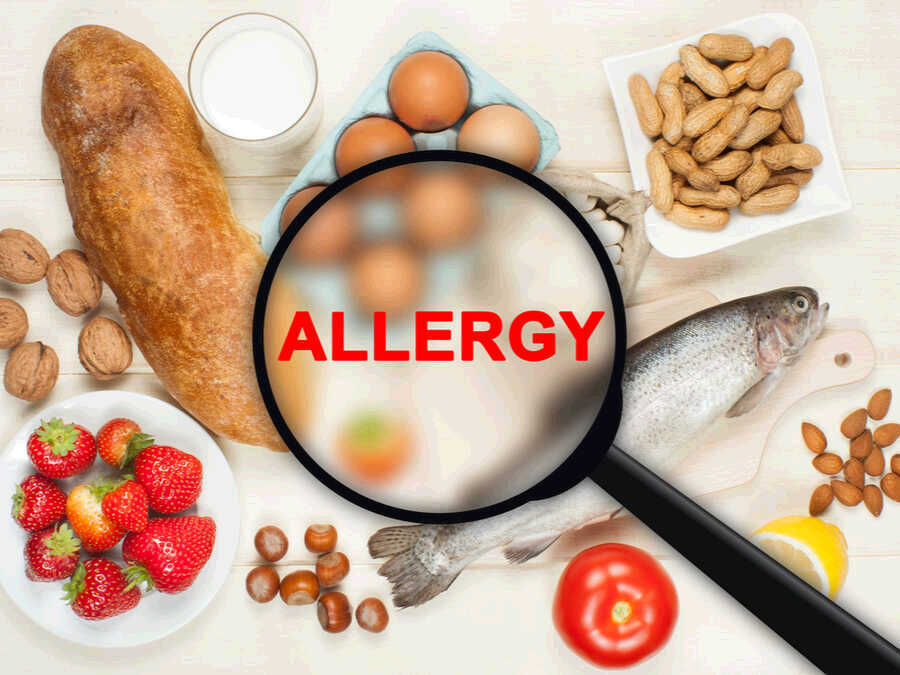 4 Expert Tips to Manage Your Food Allergies  Diets Nation